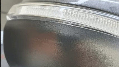 사이드미러 스쳤는데 한방병원 입원.gif